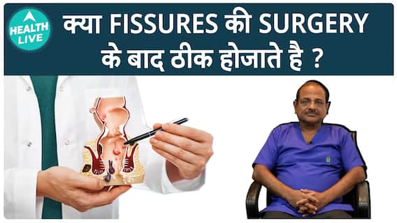 Dr. Kapil Dev Explains Immediate Recovery After Post-Fissure Surgery, Allowing Patients To Resume Work Quickly | Health Live