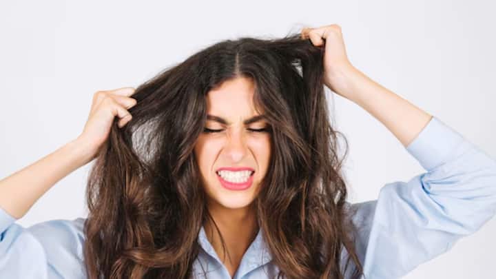 যখন খুব মাথার যন্ত্রণা হবে, চুল খুলে রাখুন। একটু বিশ্রাম নিন। চুল বেশি বড় না করে, ছেঁটে ফেলতে পারেন ছোট করে।