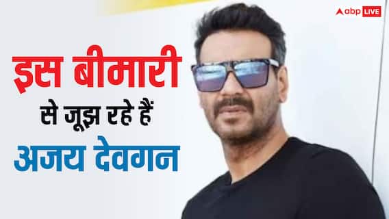 कोई भी चीज छूने के बाद अजय देवगन को होने लगती है ये परेशानी, जानें कौन सी है ये गंभीर बीमारी