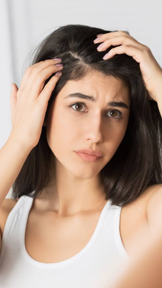 చుండ్రు సమస్యను దూరం చేసే చిట్కాలివే