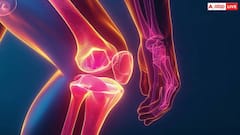 Knee Replacement Surgery: घुटने की रिप्लेसमेंट में देरी जान के लिए हो सकता है खतरनाक, हेल्थ एक्सपर्ट ने दी यह खास सलाह
