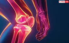 ਗੋਡਿਆਂ ਦੀ ਸਰਜਰੀ ਕਰਵਾਉਣ 'ਚ ਕਰ ਰਹੇ ਦੇਰੀ, ਤਾਂ ਜਾਣ ਲਓ ਇਸ ਦੇ ਗੰਭੀਰ ਨੁਕਸਾਨ