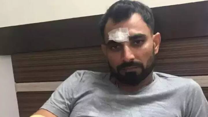 टीम इंडिया के तेज गेंदबाज मोहम्मद शमी का भी साल 2018 में कार एक्सीडेंट हो गया था. इस चोट के बाद उनकी दाहिनी आंख के ऊपर चार टांके लगे थे. शमी की ये चोट काफी गंभीर थी और उन्हें ठीक होने में काफी वक्त लग गया. (फोटो क्रेडिट: सोशल मीडिया)