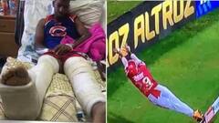 Rishabh Pant: ਰਿਸ਼ਭ ਪੰਤ ਵਾਂਗ ਭਿਆਨਕ ਹਾਦਸੇ ਦਾ ਸ਼ਿਕਾਰ ਹੋਏ ਇਹ ਖਿਡਾਰੀ, ਇੱਕ ਤਾਂ ਦੋਵੇਂ ਪੈਰ ਗੁਆਉਣ ਦੀ ਕਗਾਰ 'ਤੇ...