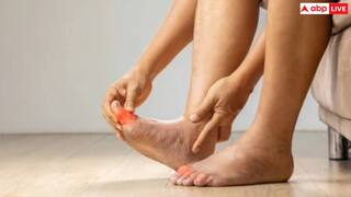 Uric Acid: एक चम्मच अजवाइन यूरिक एसिड को रातों रात कर देगा कम, जान लें कब और कैसे करना है इस्तेमाल