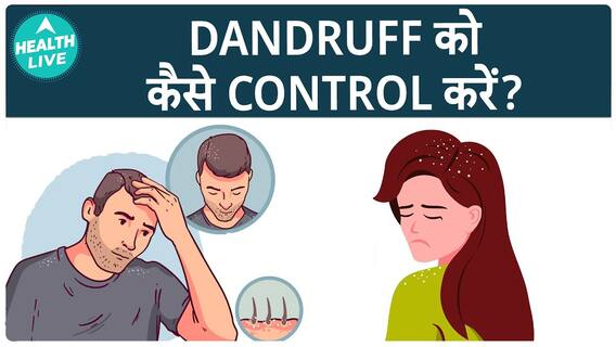 Mastering The Art Of Dandruff Control: Tips And Tricks For A Healthy, Flake-Free Scalp | Health Live