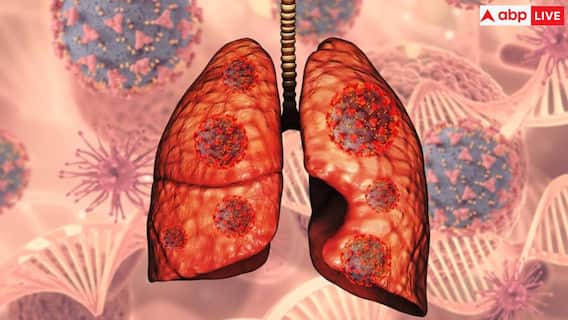 एयर पॉल्यूशन के कारण लंग्स में हो सकते हैं गंभीर इंफेक्शन, खुद को बचाने के लिए करें ये योग आसन