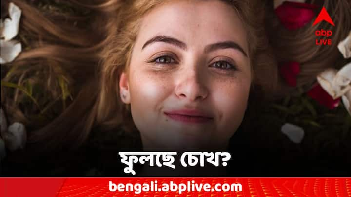 Lifestyle Tips: কেন ফুলে যায় চোখের নিচের অংশ? কীভাবে দূর করবেন?