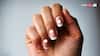 नाखूनों पर बनने लगे हैं सफेद निशान? जानें किस बीमारी का हो सकता है संकेत