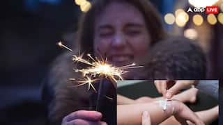 Diwali 2024: જો ફટાકડા ફોડતી વખતે હાથ દાઝી જાવ, તો તાત્કાલિક કરો આ કામ, શરીર પર નહીં દેખાય બળવાના નિશાન