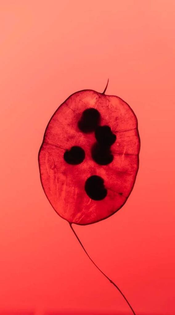 बच्चेदानी में गांठ बनना कितना खतरनाक?