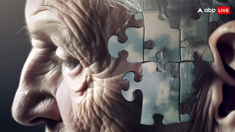 Good news! A cure for Alzheimer’s disease found, Indian scientists have worked wonders