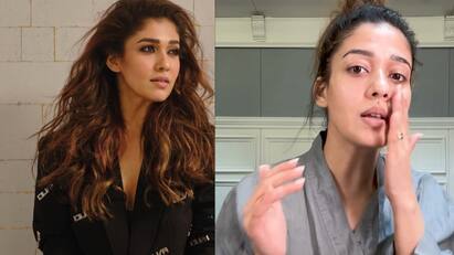 Actress Nayanthara responds to plastic surgery rumours Burn me pinch me Nayanthara : எரிச்சு பாத்தாலும்.. கிள்ளி பாத்தாலும்.. பிளாஸ்டிக் சர்ஜரி விமர்சனம்.. நயன்தாரா பதிலடி