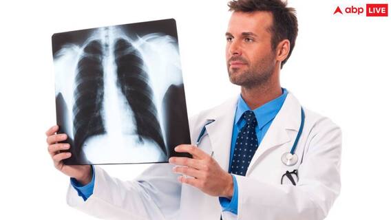 Tuberculosis Disease: कोरोना की जगह ले सकता है TB, हर साल इतने लाख लोग हो रहे हैं बीमार