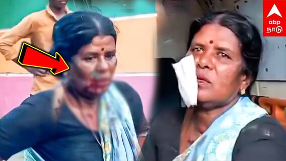 Sivagangai News | தம்பி மனைவியின் உதட்டைகடித்து கொதறிய அண்ணன்!சிவகங்கையில் அதிர்ச்சி சம்பவம்