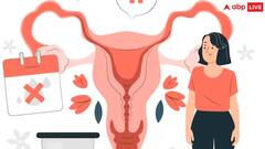 PCOSના કારણે શરીરમાં આ પોષક તત્વોની ઉણપ થાય છે, ગર્ભ ધારણ કરવામાં થાય છે મુશ્કેલી