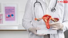 PCOS की वजह से शरीर में होने लगती है इन पोषक तत्वों की कमी, कंसीव करने में होती है दिक्कत