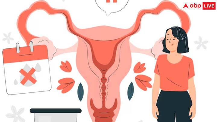 लड़कियों और महिलाओं में pcos की समस्या काफी ज्यादा आम हो गई है. इसी के कारण आजकल महिलाएं मोटापा, पीरियड्स में दिक्कत, एक्न और इनफर्टिलिटी जैसी स्वास्थ्य से जुड़ी समस्याओं का सामना करती हैं.