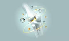 વૃદ્ધાવસ્થામાં પણ લોખંડ જેવા મજબૂત હાડકા રહેશે, તમારા રોજિંદા આહારમાં આ વસ્તુઓનો સમાવેશ કરો