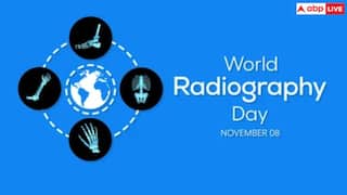 World Radiography Day: किस बीमारी में करानी पड़ती है रेडियोग्राफी, इससे कैसे मिलती है इलाज में मदद?