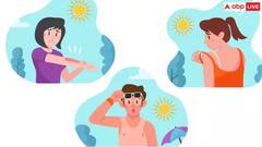 શું સૂર્યપ્રકાશના વધુ પડતા સંપર્કથી તમને ત્વચાનું કેન્સર થઈ શકે છે? જાણો શું છે વાસ્તવિકતા