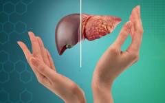 Fatty Liver:  ફેટી લીવરની સમસ્યાથી પરેશાન હોય તો કરો આ ઉપાય, થશે ફાયદો 