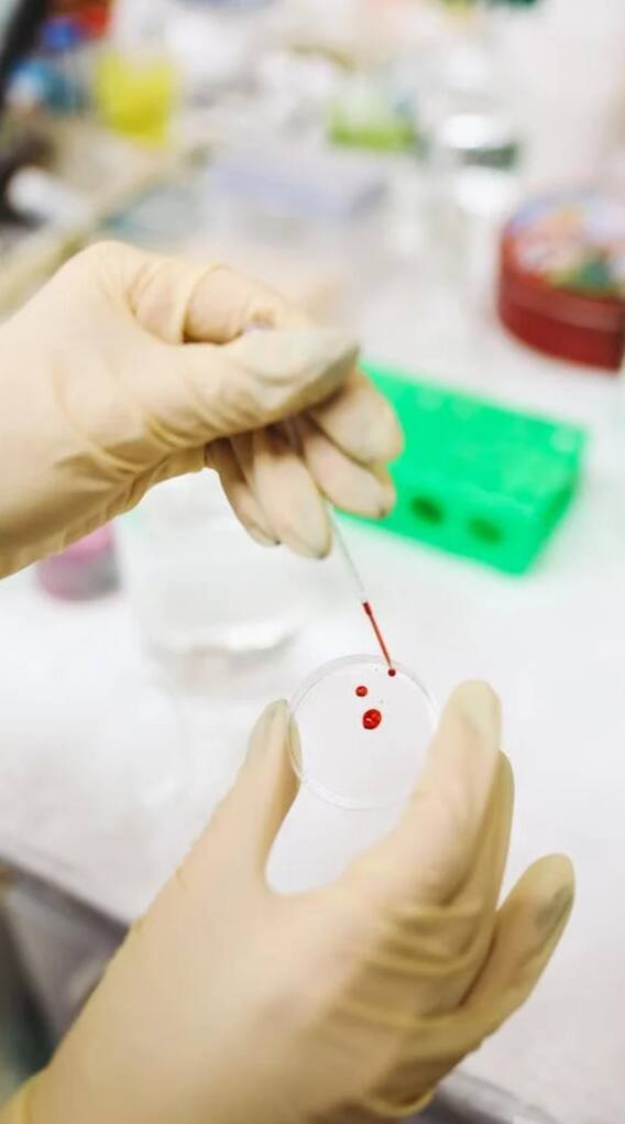 खून को पतला कर देते हैं ये फल