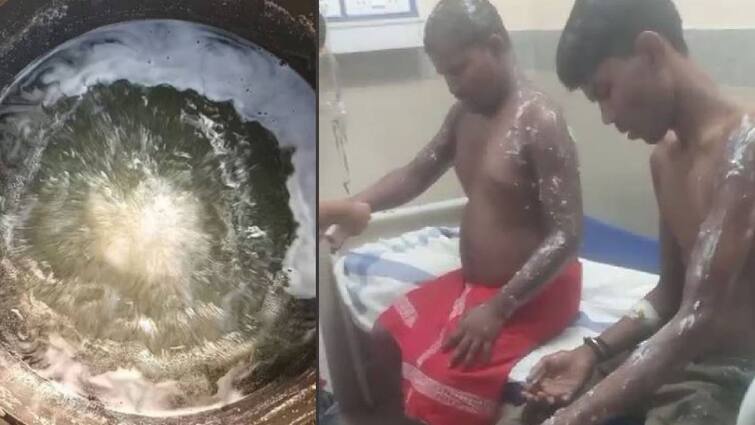 katihar mutual dispute in bihar, Two people were burnt with hot sweet juice