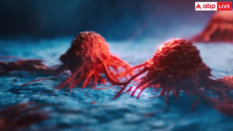 Pancreatic cancer is very difficult to detect, know its symptoms