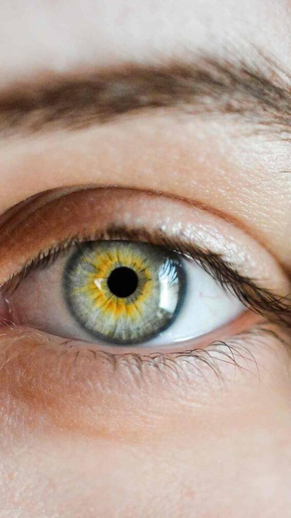 क्या एक ही इंसान की आंखों का रंग अलग-अलग हो सकता है?