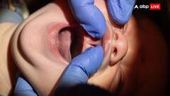 हैरान कर देने वाली प्रथा! शादी से पहले जीभ, कान और नाट काटने की परंपरा कहां जारी है