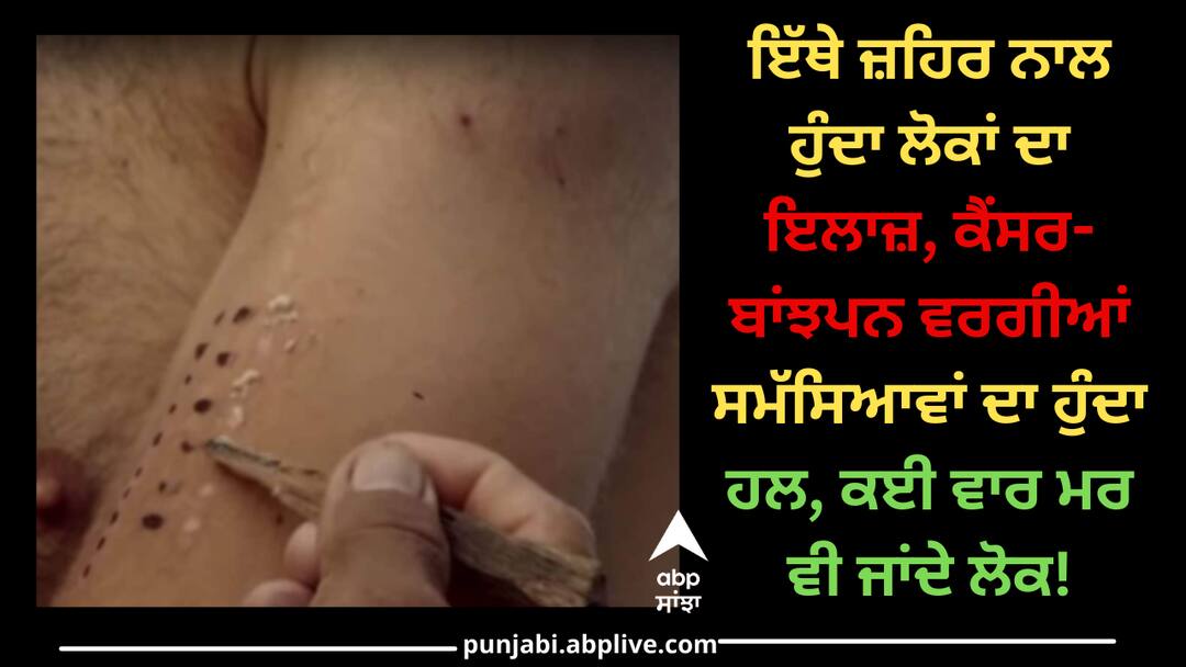 ਇੱਥੇ ਜ਼ਹਿਰ ਨਾਲ ਹੁੰਦਾ ਲੋਕਾਂ ਦਾ ਇਲਾਜ਼, ਕੈਂਸਰ-ਬਾਂਝਪਨ ਵਰਗੀਆਂ ਸਮੱਸਿਆਵਾਂ ਦਾ ਹੁੰਦਾ ਹਲ, ਕਈ ਵਾਰ ਮਰ ਵੀ ਜਾਂਦੇ ਲੋਕ! Here people are treated with poison, problems like cancer-infertility are solved, sometimes people even die! ਇੱਥੇ ਜ਼ਹਿਰ ਨਾਲ ਹੁੰਦਾ ਲੋਕਾਂ ਦਾ ਇਲਾਜ਼, ਕੈਂਸਰ-ਬਾਂਝਪਨ ਵਰਗੀਆਂ ਸਮੱਸਿਆਵਾਂ ਦਾ ਹੁੰਦਾ ਹਲ, ਕਈ ਵਾਰ ਮਰ ਵੀ ਜਾਂਦੇ ਲੋਕ!