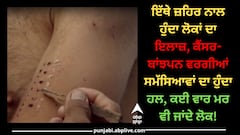 ਇੱਥੇ ਜ਼ਹਿਰ ਨਾਲ ਹੁੰਦਾ ਲੋਕਾਂ ਦਾ ਇਲਾਜ਼, ਕੈਂਸਰ-ਬਾਂਝਪਨ ਵਰਗੀਆਂ ਸਮੱਸਿਆਵਾਂ ਦਾ ਹੁੰਦਾ ਹਲ, ਕਈ ਵਾਰ ਮਰ ਵੀ ਜਾਂਦੇ ਲੋਕ!