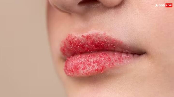 શુષ્ક ત્વચાથી લઈને સૂકા હોઠ માટે ઘી ખૂબ જ અસરકારક ઉપાય સાબિત થઈ શકે છે. ઘીનો ઉપયોગ સદીઓથી લિપ બામ તરીકે કરવામાં આવે છે, તેમાં ઘણા મહત્વપૂર્ણ પોષક તત્વો હોય છે, જે તમારા હોઠને પોષણ આપે છે અને શુષ્કતા ઘટાડવાની સાથે તમારા હોઠને કોમળ અને સુંદર બનાવે છે.