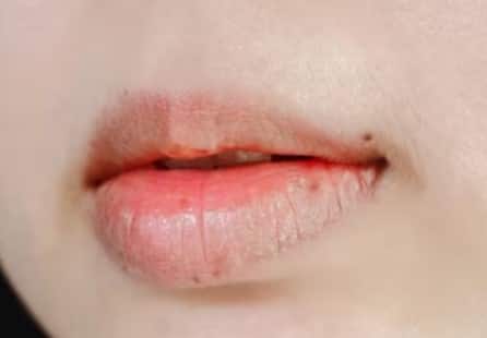 ઠંડા વાતાવરણમાં ડ્રાયનેસ વધવાથી હોઠ પણ શુષ્ક થવા લાગે છે. શુષ્કતાને કારણે હોઠમાં તિરાડો દેખાય છે, જે ક્યારેક ચેપ લાગે છે અને ઘા બની જાય છે. આવી સમસ્યાઓથી બચવા માટે તમારી ત્વચામાં ભેજ જાળવવાની સાથે તમારા હોઠને મોઇશ્ચરાઇઝ કરવા પર પણ ધ્યાન આપો. આ માટે તમારે તમારા હોઠની નિયમિત સંભાળ પર ધ્યાન આપવું જોઈએ.