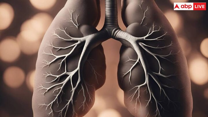 Treatment of COPD: There is no cure for COPD, you can control this disease only by improving your lifestyle. For this, medicines like bronchodilators, steroids and oxygen therapy are usually used.