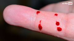 कैसा होता है इंसान के खून का स्वाद और उसकी क्या है वजह?