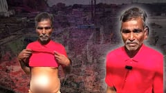 సచ్చిపోదామని యాసిడ్ తాగినా!! ఇతని స్టోరీకి కన్నీళ్లు ఆగవు!