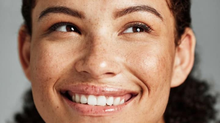 4. Fades Hyperpigmentation: Tretinoin stimulates cell renewal, reducing the appearance of dark spots, melasma, and sun damage. This evens out skin tone for a brighter, more radiant complexion. (Image Sourcce: Pinterest/starlingskin)