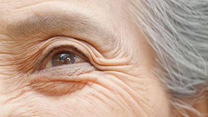 1. Reduces Fine Lines And Wrinkles: Tretinoin helps smooth fine lines and wrinkles over time by increasing collagen production. It promotes a youthful appearance by increasing skin cell turnover, making it popular in anti-ageing treatments. (Image Sourcce: Pinterest/bottomlineinc)