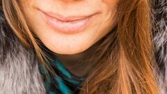 Lip Care Tips: শুধু শীতের রুক্ষ আবহাওয়া নয়, আমাদের বদভ্যাসেই বাড়ে ঠোঁট ফাটার সমস্যা