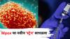 Health: सावधान! Mpox चा नवीन 'स्ट्रेन' सापडला, अमेरिकेत अलर्ट जारी, भारतासाठीही चिंता? लक्षणं जाणून घ्या