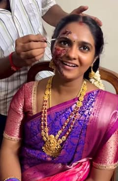 அச்சச்சோ.. விஜய் டிவி சீரியல் ஹீரோயின் ஸ்வேதாவுக்கு என்ன ஆச்சு? வைரலாகும் போட்டோஸ்!