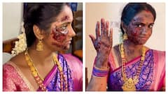 அச்சச்சோ.. விஜய் டிவி சீரியல் ஹீரோயின் ஸ்வேதாவுக்கு என்ன ஆச்சு? வைரலாகும் போட்டோஸ்!