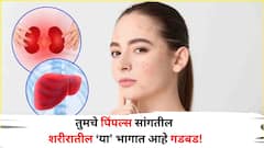 Health: किडनीपासून हृदय ते लिव्हर, तुमचे पिंपल्स सांगतील शरीरातील कोणत्या भागात आहे गडबड! जाणून घ्या
