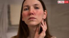 विंटर में ड्राई स्किन से चाहिए छुटकारा तो सुबह उठकर सबसे पहले करना है ये काम