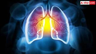 World COPD Day 2024: एयर पॉल्यूशन ले रहा है गंभीर रूप, इस दौरान लंग्स को ऐसे रखें सुरक्षित