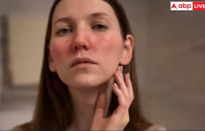 ਸਰਦੀਆਂ ਦੇ ਮਹੀਨਿਆਂ ਵਿੱਚ ਤੁਹਾਡੀ ਚਮੜੀ ਨੂੰ ਪੌਸ਼ਟਿਕ ਅਤੇ ਹਾਈਡਰੇਟ ਰੱਖਣ ਲਈ ਤੁਹਾਨੂੰ ਸਿਰਫ਼ ਇੱਕ ਵਿਆਪਕ ਗਾਈਡ ਦੀ ਲੋੜ ਹੈ, ਅਤੇ ਨਤੀਜੇ ਵਜੋਂ, ਚਮੜੀ ਬਹੁਤ ਖੁਸ਼ਕ, ਰੁੱਖੀ ਅਤੇ ਖੁਜਲੀਦਾਰ ਹੋ ਜਾਂਦੀ ਹੈ।