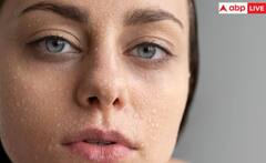 ਸਰਦੀਆਂ 'ਚ Dry Skin ਤੋਂ ਪਾਉਣਾ ਚਾਹੁੰਦੇ ਛੁਟਕਾਰਾ, ਤਾਂ ਸਭ ਤੋਂ ਪਹਿਲਾਂ ਕਰੋ ਆਹ ਕੰਮ