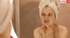 ਸਰਦੀਆਂ 'ਚ Dry Skin ਤੋਂ ਪਾਉਣਾ ਚਾਹੁੰਦੇ ਛੁਟਕਾਰਾ, ਤਾਂ ਸਭ ਤੋਂ ਪਹਿਲਾਂ ਕਰੋ ਆਹ ਕੰਮ